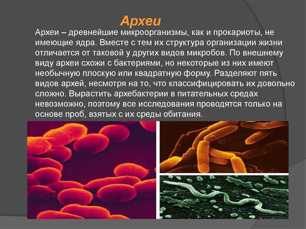 Бактерии прокариоты 5 класс. Царство археи. Прокариоты архебактерии. Археи термофилы. Надцарство археи.